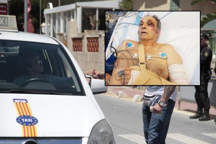 Nach der Prügelattacke durch deutsche Polizisten musste der 71-jährige Taxifahrer auf Mallorca tagelang im Krankenhaus behandelt werden